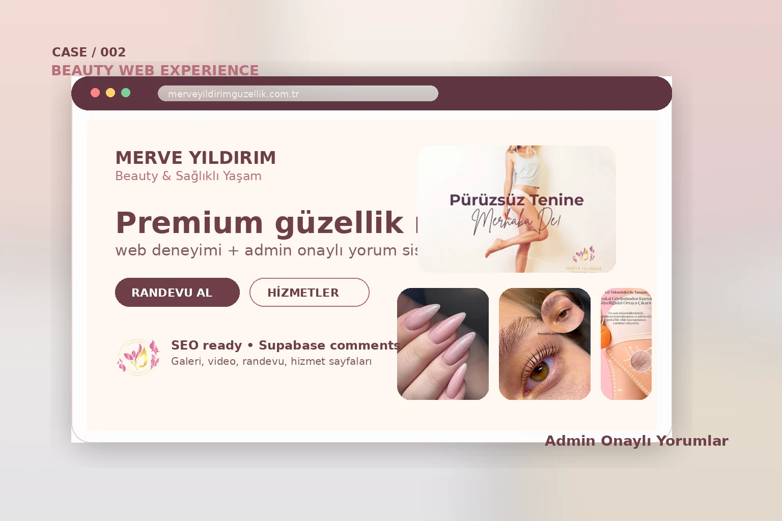Merve Yıldırım Beauty proje ön izlemesi